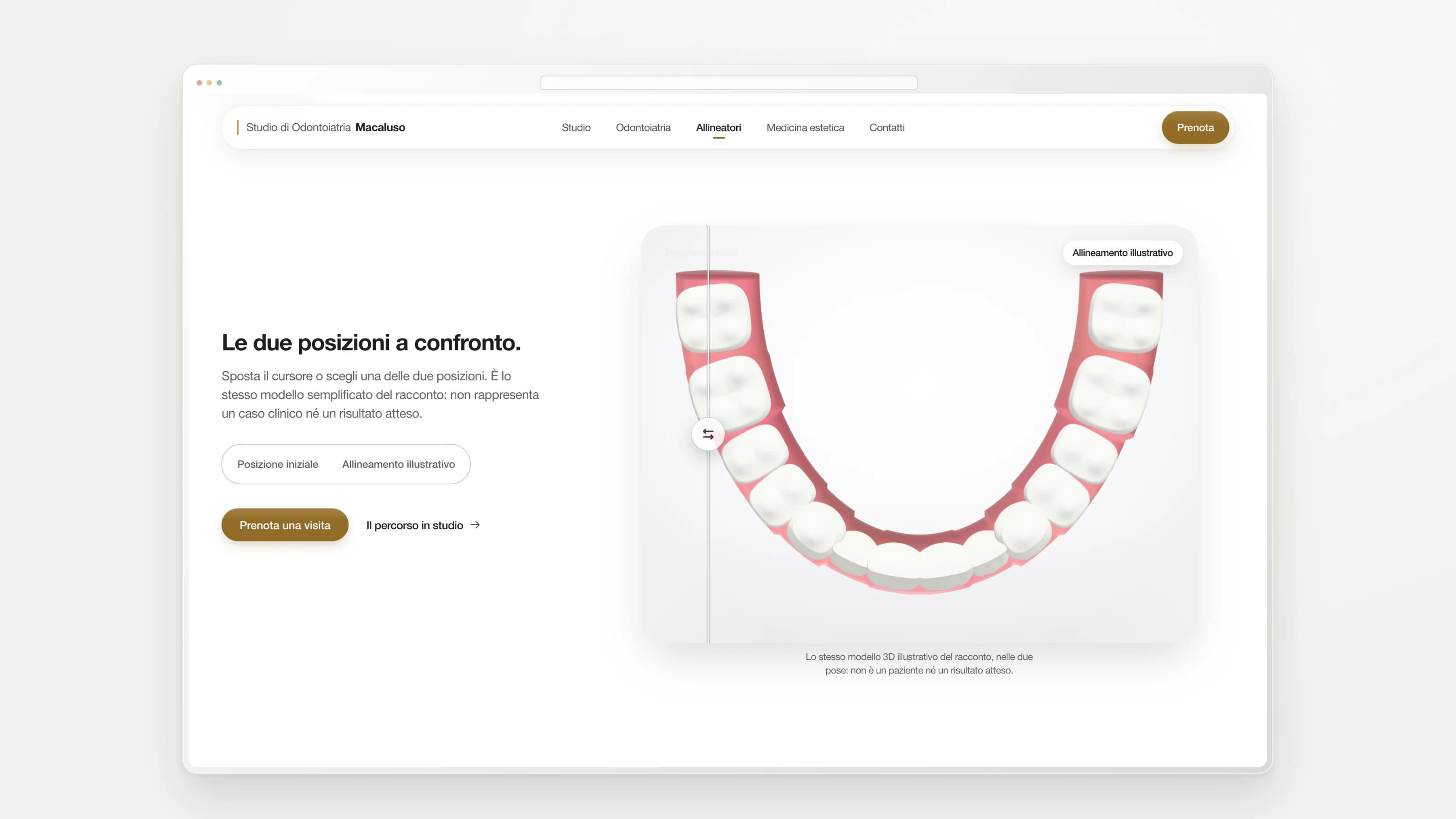 Studio Macaluso — Interactive illustrative comparison — not a clinical case or an outcome guarantee